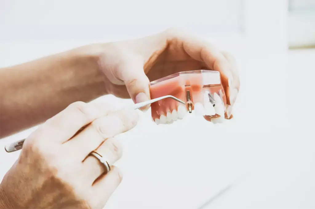 Dentist holding up a model of teeth showing the patient where their dental implant will go and informing them that they can claim tax back on this dental expense